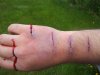 injuries.jpg